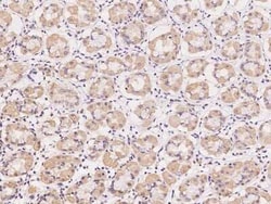 AZI2 Antibody, Novus Biologicals:Antibodies:Primary Antibodies
