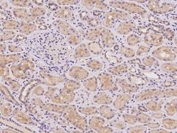 Acetoacetyl CoA synthetase Antibody, Novus Biologicals 50 &mu;g | Buy Online | Novus Biologicals | Fisher Scientific