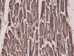 Acetyl-CoA Carboxylase alpha/ACACA Antibody (RM232), Novus Biologicals