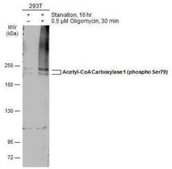 Acetyl-CoA Carboxylase alpha/ACACA, p Ser79 Antibody, Novus Biologicals