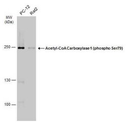 Acetyl-CoA Carboxylase alpha/ACACA, p Ser79 Antibody, Novus Biologicals