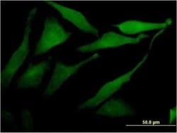 Acetyl CoA synthetase Antibody (2A10), Novus Biologicals 0.1 mg | Buy Online | Novus Biologicals | Fisher Scientific
