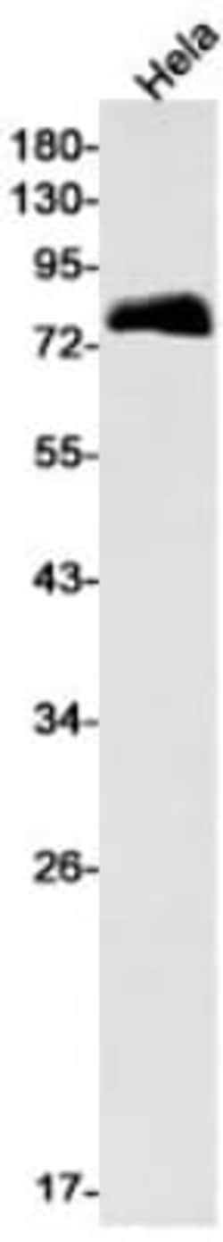 Acetyl CoA synthetase Antibody (S01-7I6), Novus Biologicals 100 &mu;g;