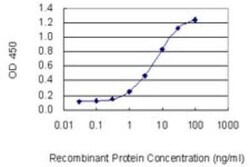Novus Biologicals Acidic Calponin Antibody (4C4), Novus Biologicals 0.1 mg | Buy Online | Novus Biologicals&trade; | Fisher Scientific
