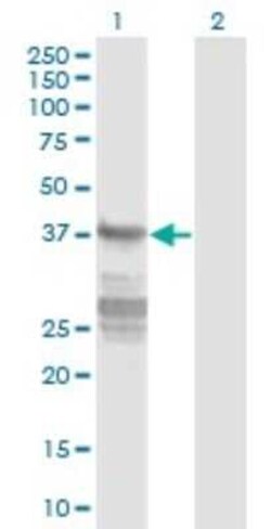Novus Biologicals Acidic Calponin Antibody (4C4), Novus Biologicals 0.1 mg | Buy Online | Novus Biologicals&trade; | Fisher Scientific