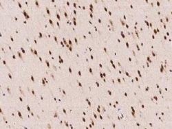 Acinus Antibody, Novus Biologicals:Antibodies:Primary Antibodies