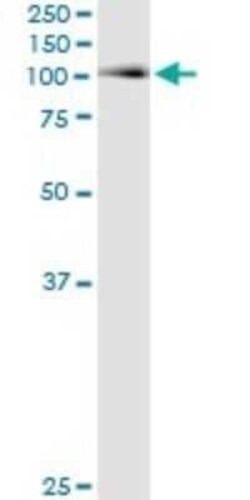 Aconitase 1 Antibody (2C1), Novus Biologicals 0.1 mg | Buy Online | Novus Biologicals | Fisher Scientific