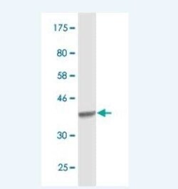 Aconitase 1 Antibody (2F6), Novus Biologicals 0.1 mg; Unconjugated:Antikörper