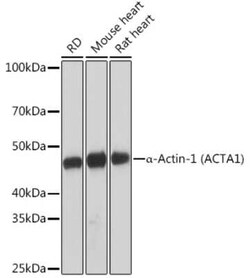 Actin Rabbit anti-Human, Mouse, Rat, Clone: 3U6B8, Novus Biologicals 100 &mu;g | Buy Online | Novus Biologicals | Fisher Scientific