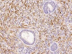 Actin Antibody, Novus Biologicals 50 &mu;g, Unconjugated:Anticuerpos