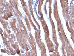 Actin (Muscle Specific) Antibody (HHF35 + MSA/953), Novus Biologicals:Antibodies:Primary