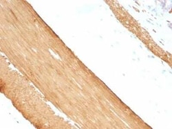 Actin (Muscle Specific) Antibody (HHF35 + MSA/953), Novus Biologicals:Antibodies:Primary