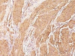 Actin (Muscle Specific) Antibody (SPM160), Novus Biologicals 0.1 mg; Unconjugated:Antibodies,