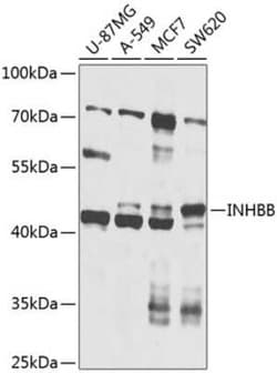 Activin B/Inhibin beta B Antibody - BSA Free, Novus Biologicals 0.02 mL,