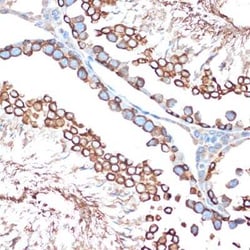 Activin RIB/ALK-4 Rabbit anti-Human, Mouse, Rat, Clone: 3U6I8, Novus Biologicals