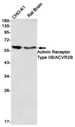 Activin RIIB Antibody (S01-2I1), Novus Biologicals:Antibodies:Primary Antibodies