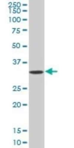 Adenine Nucleotide Translocator 2 Antibody, Novus Biologicals 0.05 mg | Buy Online | Novus Biologicals | Fisher Scientific