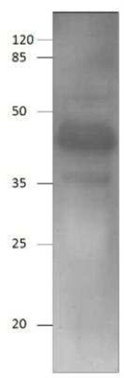 Adenine Nucleotide Translocator 2 Antibody, Novus Biologicals 100 &mu;g | Buy Online | Novus Biologicals | Fisher Scientific