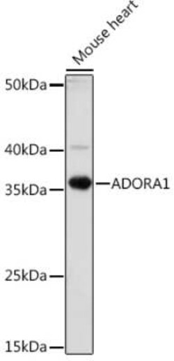 Adenosine A1R Rabbit anti-Human, Mouse, Rat, Polyclonal, Novus Biologicals 100 &mu;g | Buy Online | Novus Biologicals | Fisher Scientific