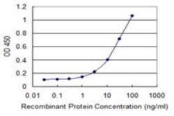 Adenosine Deaminase 2/CECR1 Antibody (3D11), Novus Biologicals 0.1 mg | Buy Online | Novus Biologicals | Fisher Scientific