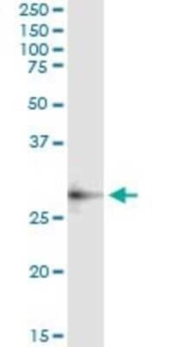 Adenosine Deaminase 2/CECR1 Antibody (3D11), Novus Biologicals 0.1 mg | Buy Online | Novus Biologicals | Fisher Scientific