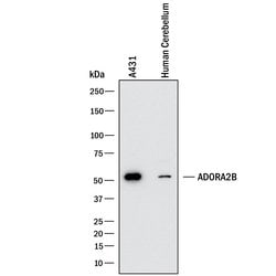 Human Adenosine A2b R Antibody, R D Systems 25 &mu;g | Buy Online | R&D Systems | Fisher Scientific