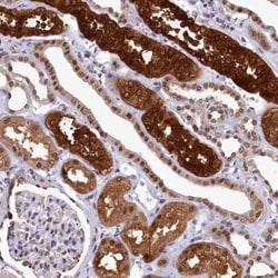 Adenosylhomocysteinase/AHCY Antibody, Novus Biologicals:Antibodies:Primary
