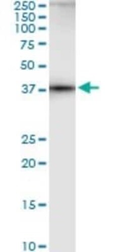 Adenosylhomocysteinase/AHCY Antibody (M2), Novus Biologicals 0.1 mg | Buy Online | Novus Biologicals | Fisher Scientific
