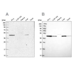 Adenosylhomocysteinase/AHCY Antibody, Novus Biologicals:Antibodies:Primary