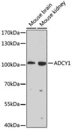 Adenylate Cyclase 1 Antibody - BSA Free, Novus Biologicals 0.1 mL, Unconjugated:Antibodies,