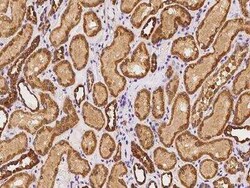 Adenylate Cyclase 5 Antibody, Novus Biologicals:Anticorps:Anticorps primaires