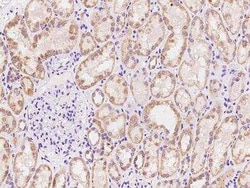 Adenylate Cyclase 7 Antibody, Novus Biologicals 50 &mu;g, Unconjugated:Antibodies,
