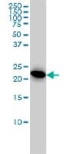 Adenylate Kinase 1 Antibody (3A6-1F5), Novus Biologicals 0.1 mg | Buy Online | Novus Biologicals | Fisher Scientific