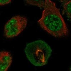 Adenylate Kinase 6 Rabbit anti-Human, Polyclonal, Novus Biologicals 100