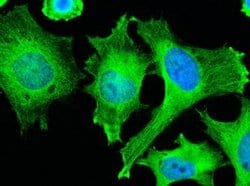 Adenylosuccinate Lyase Rabbit anti-Human, Clone: 7, Novus Biologicals:Antibodies:Primary