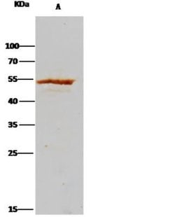 Adenylosuccinate Lyase Rabbit anti-Human, Clone: 7, Novus Biologicals:Antibodies:Primary