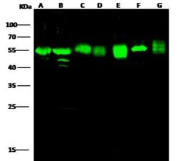 Adenylosuccinate Lyase Rabbit anti-Human, Clone: 7, Novus Biologicals:Antibodies:Primary