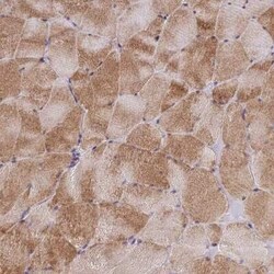 AdipoR2 Antibody, Novus Biologicals 25 &mu;L; Unconjugated:Antibodies,