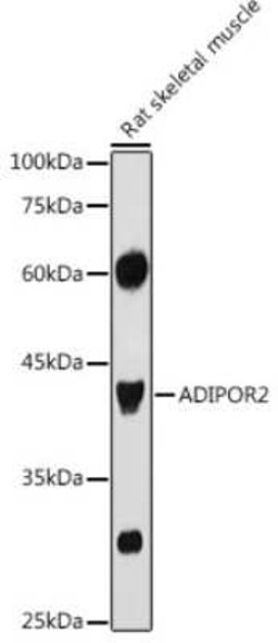 AdipoR2 Antibody - Azide and BSA Free, Novus Biologicals 0.1 mL, Unconjugated:Antibodies,