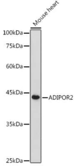 AdipoR2 Antibody - Azide and BSA Free, Novus Biologicals 0.1 mL, Unconjugated:Antibodies,