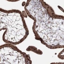 Adrenomedullin/ADM Rabbit anti-Human, Polyclonal, Novus Biologicals 100