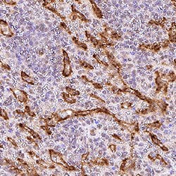 Human Adrenomedullin R/ADMR Antibody, R D Systems:Antibodies:Primary Antibodies