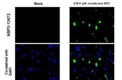 African Swine Fever Virus p54 Antibody (GT1075), Novus Biologicals 100 &mu;g | Buy Online | Novus Biologicals | Fisher Scientific