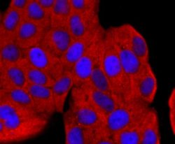 Ago2/eIF2C2 Antibody (JF0992), Novus Biologicals 100&mu;L:Antibodies, Monoclonal