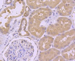 Ago2/eIF2C2 Antibody (JF0992), Novus Biologicals 100&mu;L:Antibodies, Monoclonal