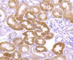 Ago2/eIF2C2 Antibody (JF0992), Novus Biologicals 100&mu;L:Antibodies, Monoclonal
