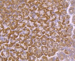 Ago2/eIF2C2 Antibody (JF0992), Novus Biologicals 100&mu;L:Antibodies, Monoclonal