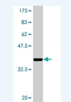 Ago2/eIF2C2 Antibody (2H2), Novus Biologicals 0.1 mg | Buy Online | Novus Biologicals | Fisher Scientific