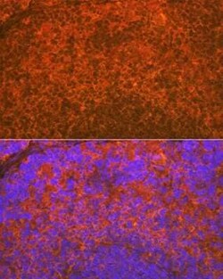 Aiolos/IKZF3 Rabbit anti-Human, Mouse, Rat, Clone: 4V2Z2, Novus Biologicals:Antibodies:Primary