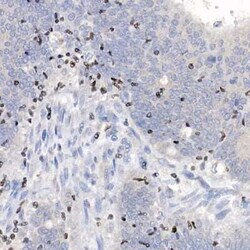 Aiolos/IKZF3 Rabbit anti-Human, Mouse, Rat, Clone: 4V2Z2, Novus Biologicals:Antibodies:Primary